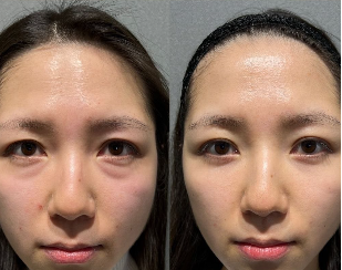 馬場 様の使用前後の比較